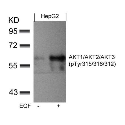 Western blot - AKT1/AKT2/AKT3 (phospho-Tyr315/316/312) Antibody from Signalway Antibody (11501) - Antibodies.com