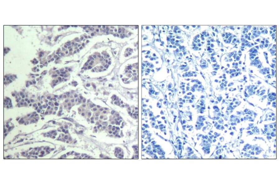Immunohistochemistry - AKT1/AKT2/AKT3 (phospho-Tyr315/316/312) Antibody from Signalway Antibody - Antibodies.com