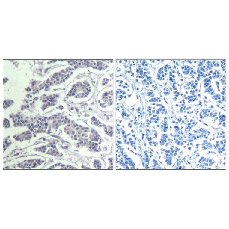 Immunohistochemistry - AKT1/AKT2/AKT3 (phospho-Tyr315/316/312) Antibody from Signalway Antibody - Antibodies.com