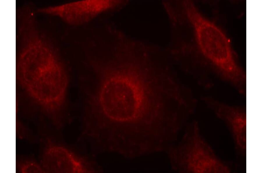 Immunofluorescence - AKT1/AKT2/AKT3 (phospho-Tyr315/316/312) Antibody from Signalway Antibody - Antibodies.com