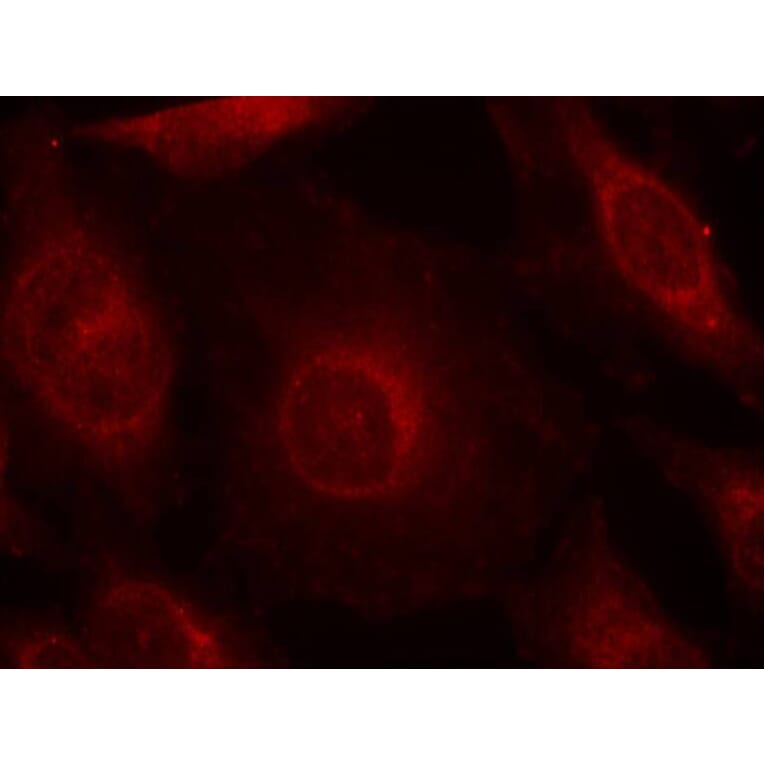 Immunofluorescence - AKT1/AKT2/AKT3 (phospho-Tyr315/316/312) Antibody from Signalway Antibody - Antibodies.com