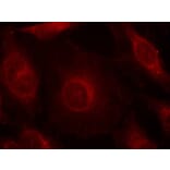 Immunofluorescence - AKT1/AKT2/AKT3 (phospho-Tyr315/316/312) Antibody from Signalway Antibody - Antibodies.com