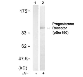 Western blot - Progesterone Receptor (Phospho-Ser190) Antibody from Signalway Antibody (11074) - Antibodies.com