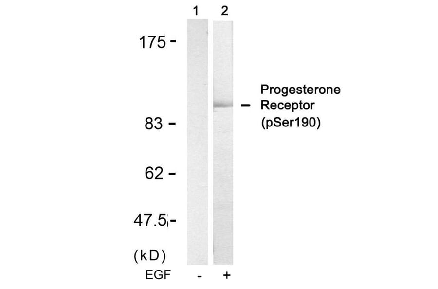 Western blot - Progesterone Receptor (Phospho-Ser190) Antibody from Signalway Antibody (11074) - Antibodies.com