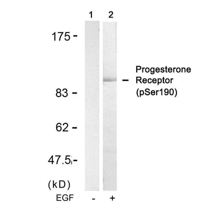 Western blot - Progesterone Receptor (Phospho-Ser190) Antibody from Signalway Antibody (11074) - Antibodies.com