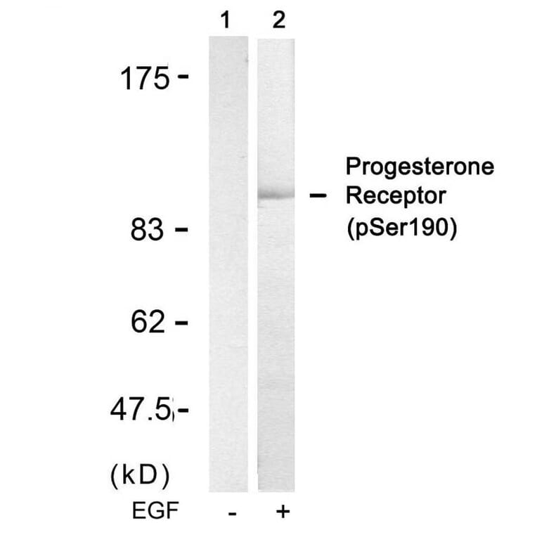Western blot - Progesterone Receptor (Phospho-Ser190) Antibody from Signalway Antibody (11074) - Antibodies.com
