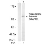 Western blot - Progesterone Receptor (Phospho-Ser190) Antibody from Signalway Antibody (11074) - Antibodies.com