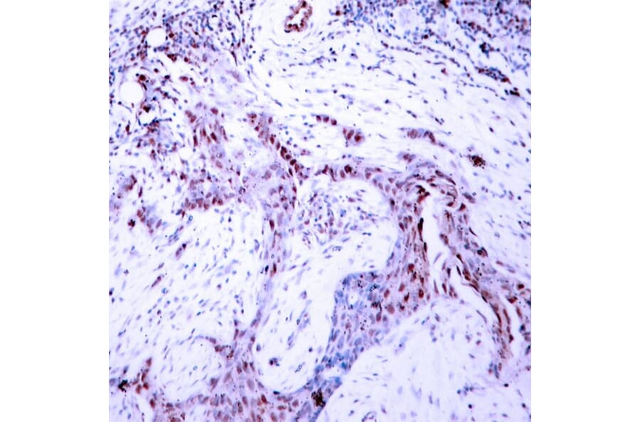 Immunohistochemistry - Progesterone Receptor (Phospho-Ser190) Antibody from Signalway Antibody - Antibodies.com
