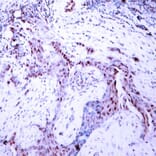 Immunohistochemistry - Progesterone Receptor (Phospho-Ser190) Antibody from Signalway Antibody - Antibodies.com