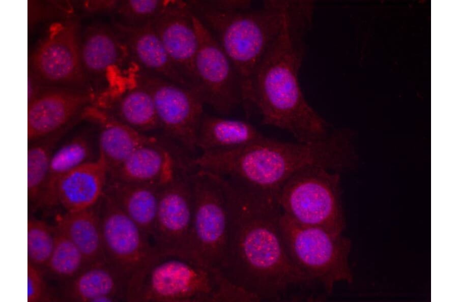 Immunofluorescence - Progesterone Receptor (Phospho-Ser190) Antibody from Signalway Antibody - Antibodies.com