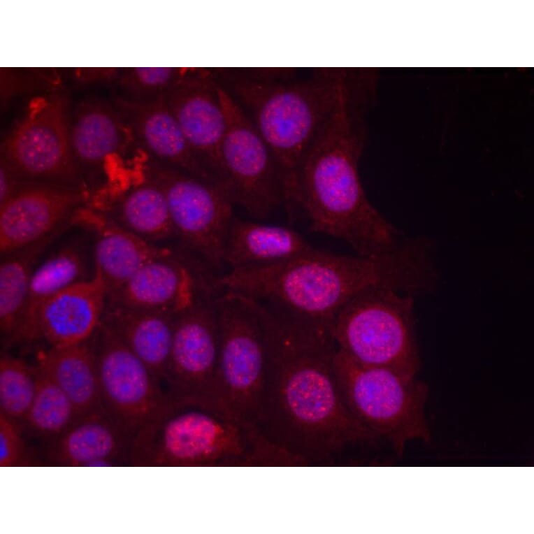 Immunofluorescence - Progesterone Receptor (Phospho-Ser190) Antibody from Signalway Antibody - Antibodies.com