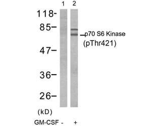 Western blot - p70 S6 Kinase (Phospho-Thr421) Antibody from Signalway Antibody (11254) - Antibodies.com