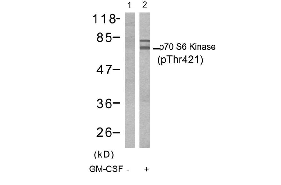 Western blot - p70 S6 Kinase (Phospho-Thr421) Antibody from Signalway Antibody (11254) - Antibodies.com