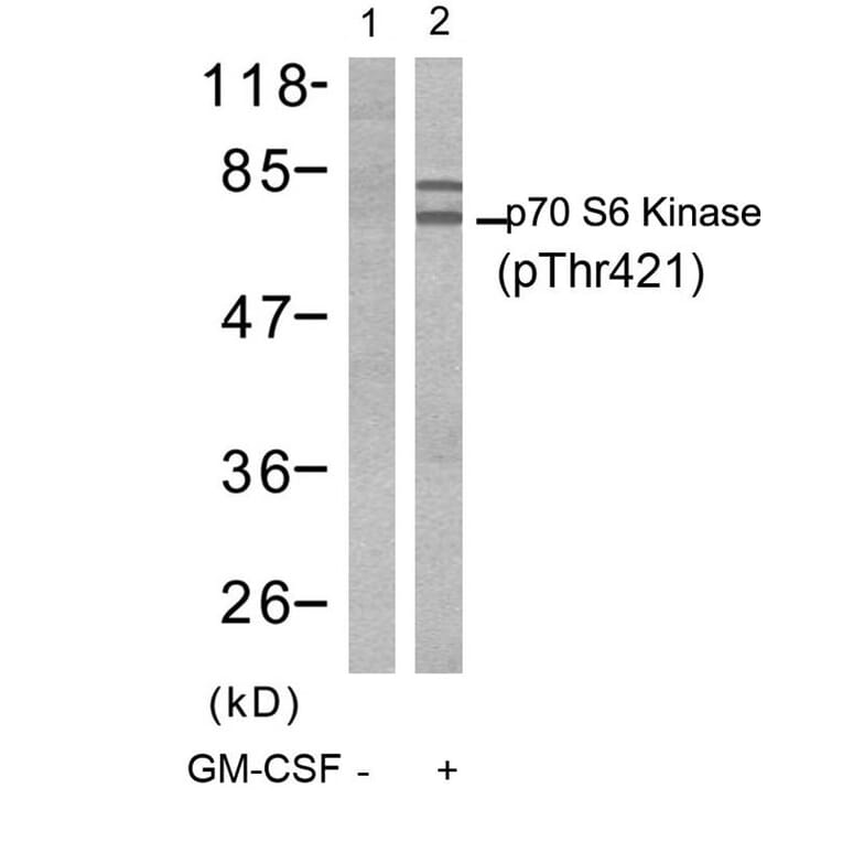 Western blot - p70 S6 Kinase (Phospho-Thr421) Antibody from Signalway Antibody (11254) - Antibodies.com