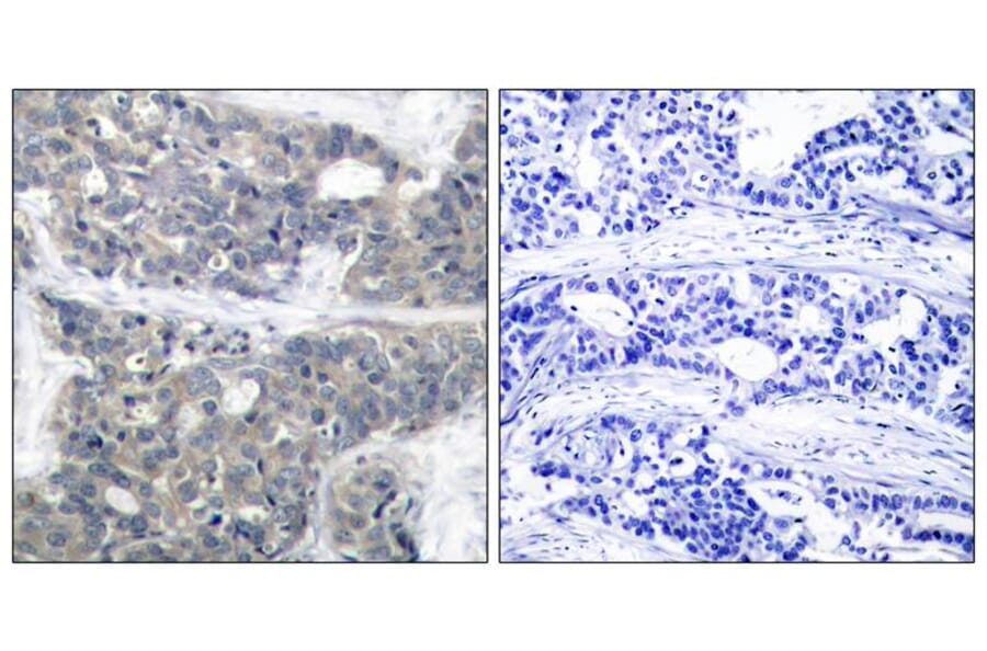 Immunohistochemistry - p70 S6 Kinase (Phospho-Thr421) Antibody from Signalway Antibody (11254) - Antibodies.com