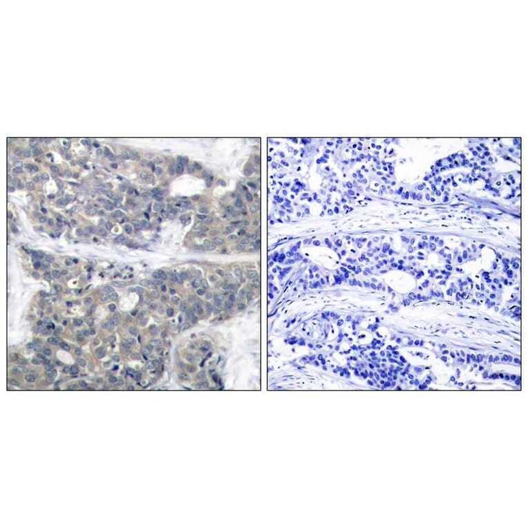 Immunohistochemistry - p70 S6 Kinase (Phospho-Thr421) Antibody from Signalway Antibody (11254) - Antibodies.com