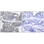 Immunohistochemistry - p70 S6 Kinase (Phospho-Thr421) Antibody from Signalway Antibody (11254) - Antibodies.com