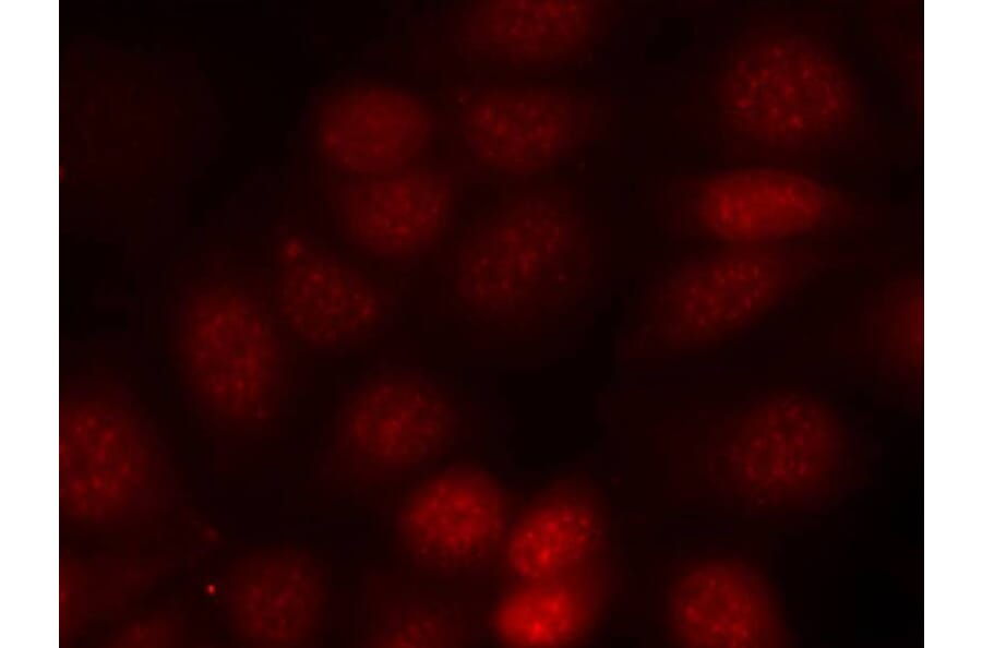 Immunofluorescence - p70 S6 Kinase (Phospho-Thr421) Antibody from Signalway Antibody (11254) - Antibodies.com