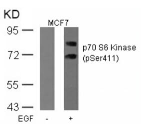 Western blot - p70 S6 Kinase (Phospho-Ser411) Antibody from Signalway Antibody (11269) - Antibodies.com