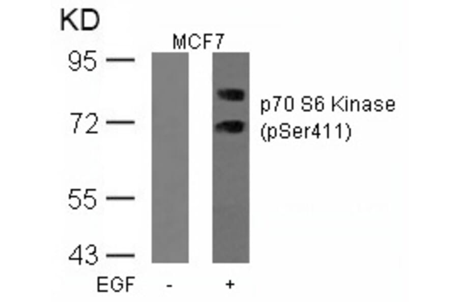 Western blot - p70 S6 Kinase (Phospho-Ser411) Antibody from Signalway Antibody (11269) - Antibodies.com