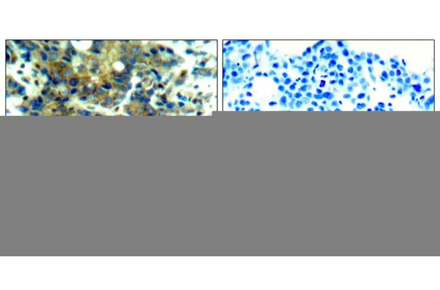 Immunohistochemistry - p70 S6 Kinase (Phospho-Ser411) Antibody from Signalway Antibody (11269) - Antibodies.com