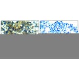 Immunohistochemistry - p70 S6 Kinase (Phospho-Ser411) Antibody from Signalway Antibody (11269) - Antibodies.com