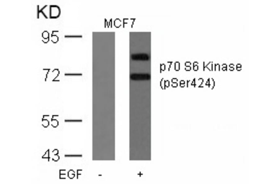 Western blot - p70 S6 Kinase (Phospho-Ser424) Antibody from Signalway Antibody (11284) - Antibodies.com