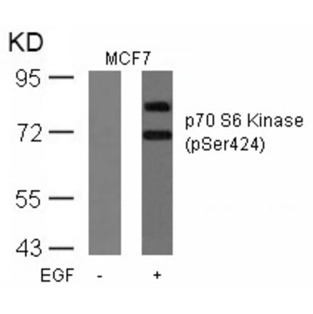 Western blot - p70 S6 Kinase (Phospho-Ser424) Antibody from Signalway Antibody (11284) - Antibodies.com