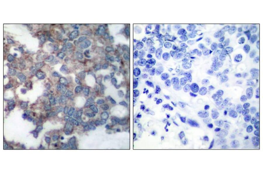 Immunohistochemistry - p70 S6 Kinase (Phospho-Ser424) Antibody from Signalway Antibody (11284) - Antibodies.com