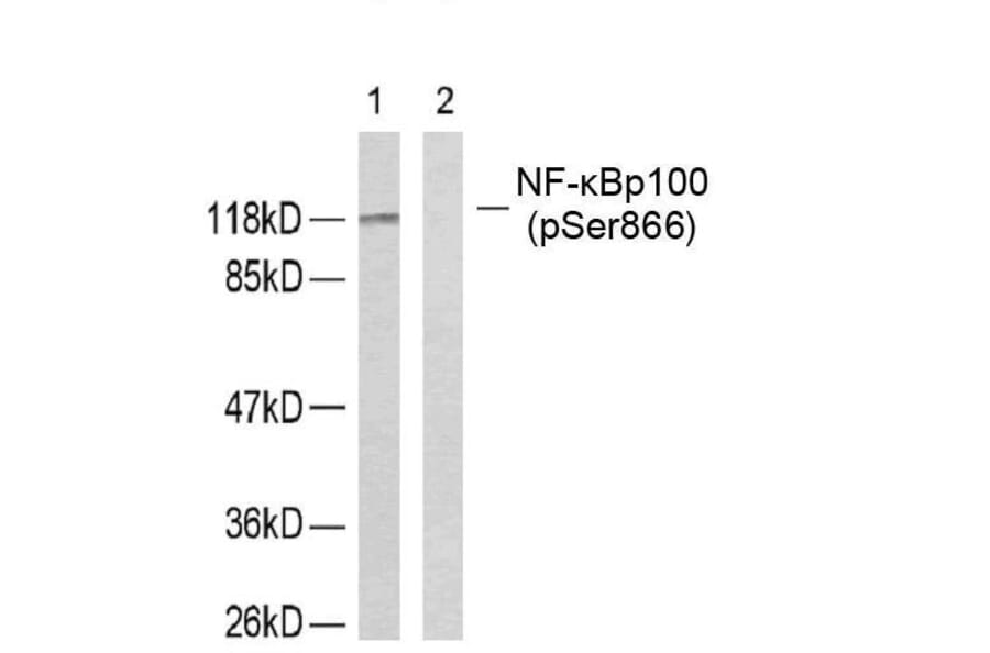 Western blot - NFκB-p100 (Phospho-Ser866) Antibody from Signalway Antibody (11015) - Antibodies.com