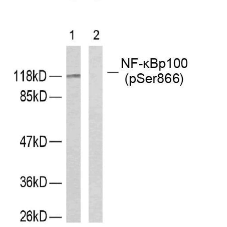 Western blot - NFκB-p100 (Phospho-Ser866) Antibody from Signalway Antibody (11015) - Antibodies.com