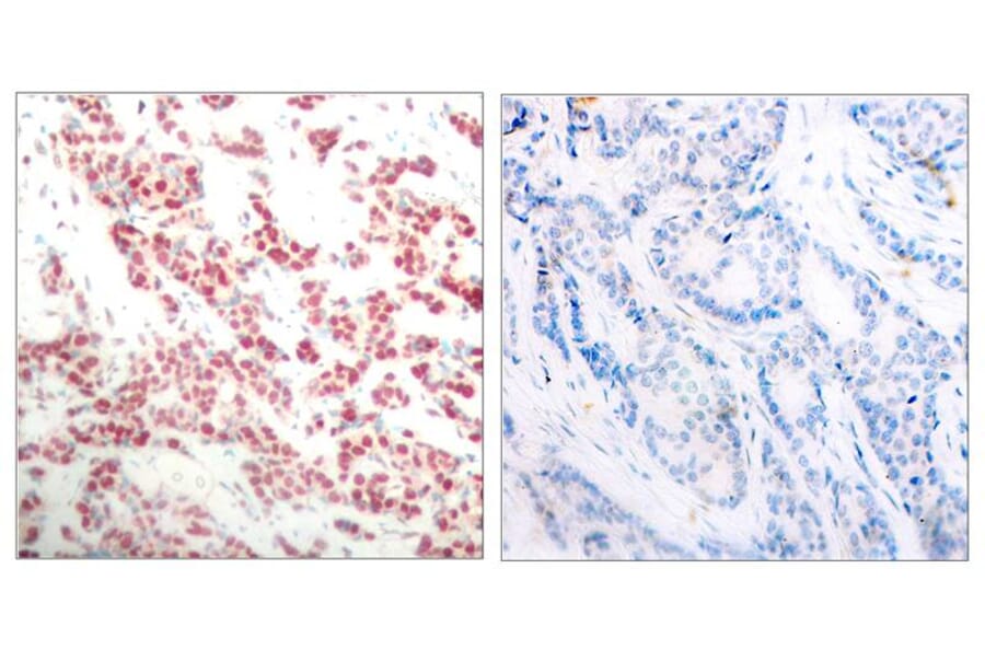 Immunohistochemistry - NFκB-p100 (Phospho-Ser866) Antibody from Signalway Antibody (11015) - Antibodies.com