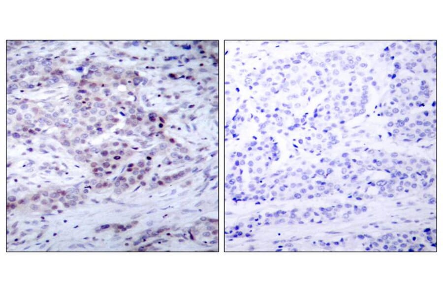 Immunohistochemistry - NFκB-p100 (Phospho-Ser870) Antibody from Signalway Antibody (11016) - Antibodies.com