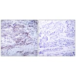 Immunohistochemistry - NFκB-p100 (Phospho-Ser870) Antibody from Signalway Antibody (11016) - Antibodies.com