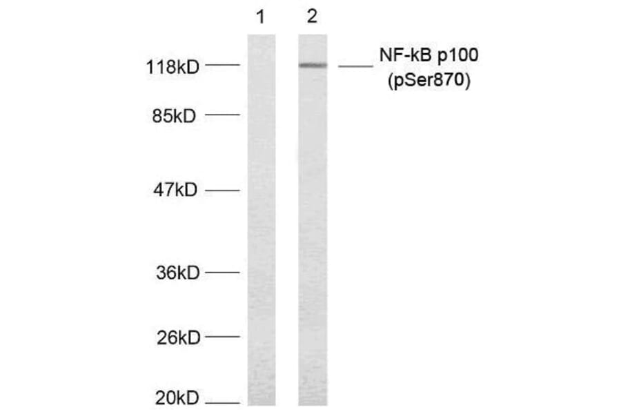 Western blot - NFκB-p100 (Phospho-Ser870) Antibody from Signalway Antibody (11016) - Antibodies.com