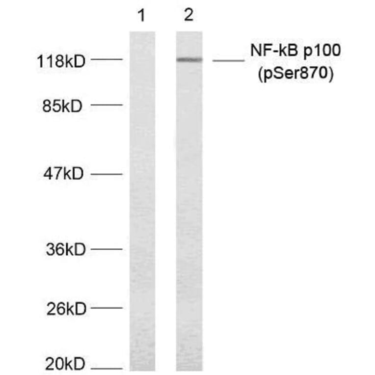 Western blot - NFκB-p100 (Phospho-Ser870) Antibody from Signalway Antibody (11016) - Antibodies.com