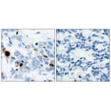 Immunohistochemistry - Histone H3.1 (Phospho-Ser10) Antibody from Signalway Antibody (11184) - Antibodies.com
