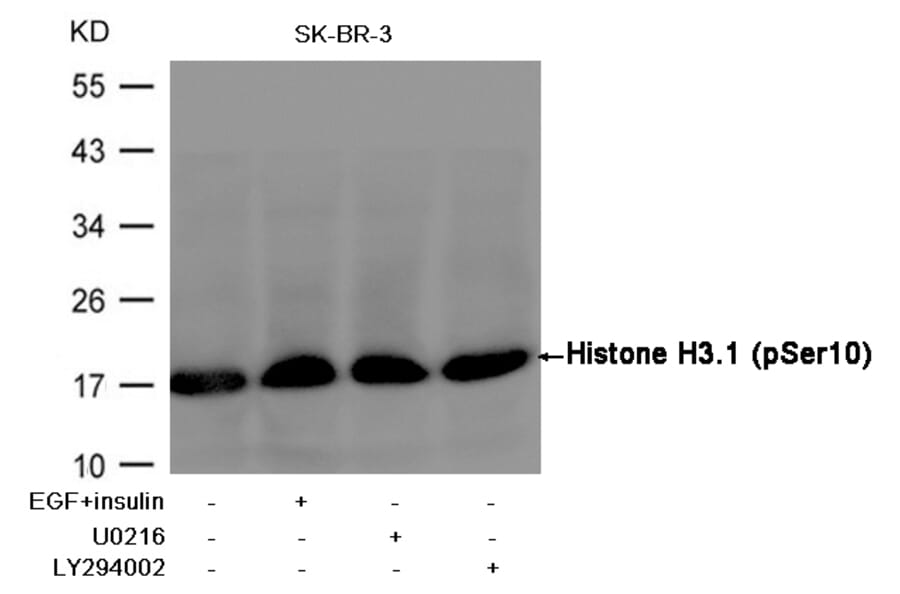 Western blot - Histone H3.1 (Phospho-Ser10) Antibody from Signalway Antibody (11184) - Antibodies.com