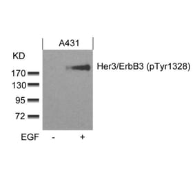 Western blot - Her3/ErbB3 (phospho-Tyr1328) Antibody from Signalway Antibody (11510) - Antibodies.com