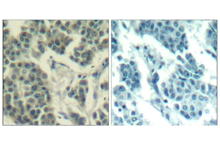 Immunohistochemistry - Her3/ErbB3 (phospho-Tyr1328) Antibody from Signalway Antibody (11510) - Antibodies.com