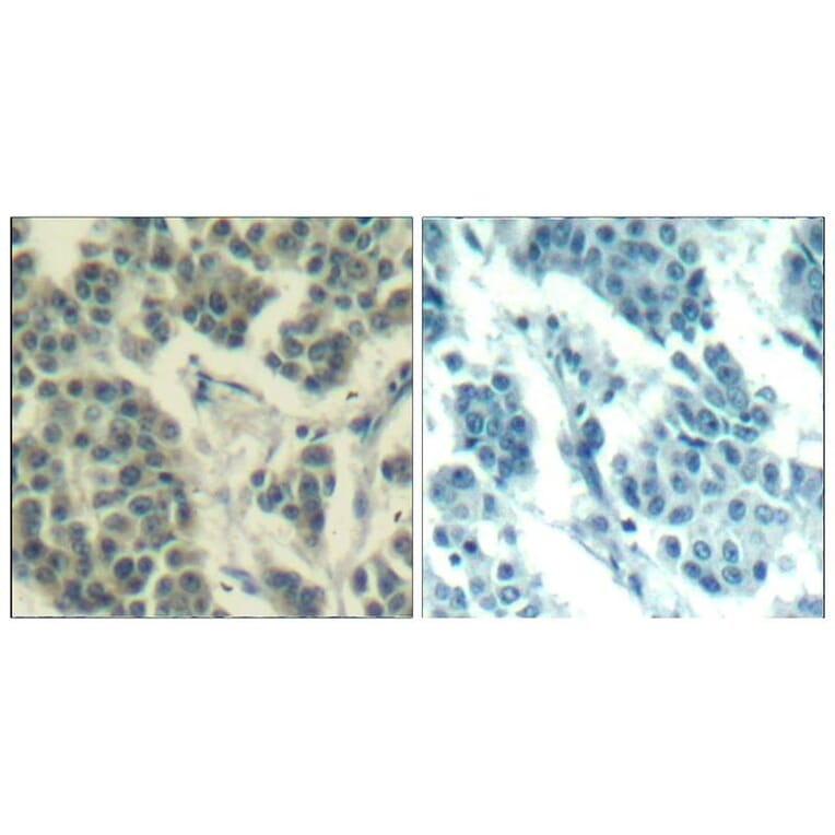 Immunohistochemistry - Her3/ErbB3 (phospho-Tyr1328) Antibody from Signalway Antibody (11510) - Antibodies.com