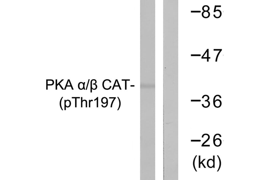Western blot - PKA α/β CAT (Phospho-Thr197) Antibody from Signalway Antibody (11667) - Antibodies.com