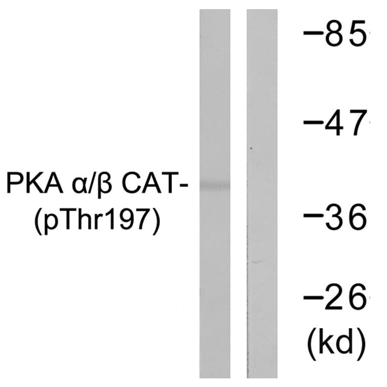 Western blot - PKA α/β CAT (Phospho-Thr197) Antibody from Signalway Antibody (11667) - Antibodies.com