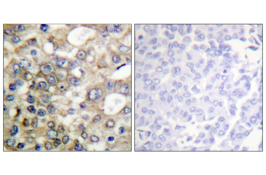 Immunohistochemistry - CD227/MUC1 (Phospho-Tyr1229) Antibody from Signalway Antibody (11707) - Antibodies.com