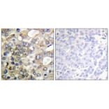 Immunohistochemistry - CD227/MUC1 (Phospho-Tyr1229) Antibody from Signalway Antibody (11707) - Antibodies.com