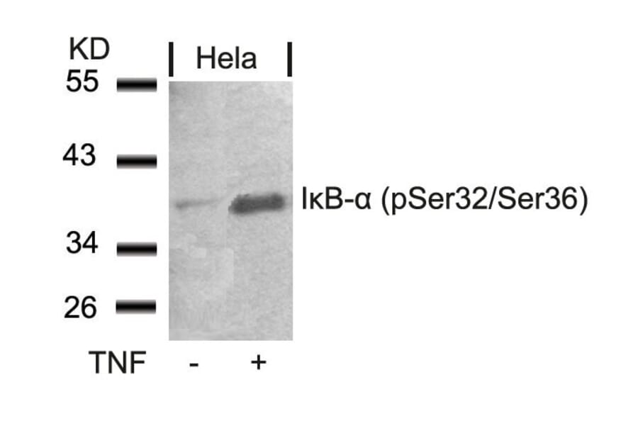 Western blot - IkB-a (Phospho-Ser32/Ser36) Antibody from Signalway Antibody (11152) - Antibodies.com
