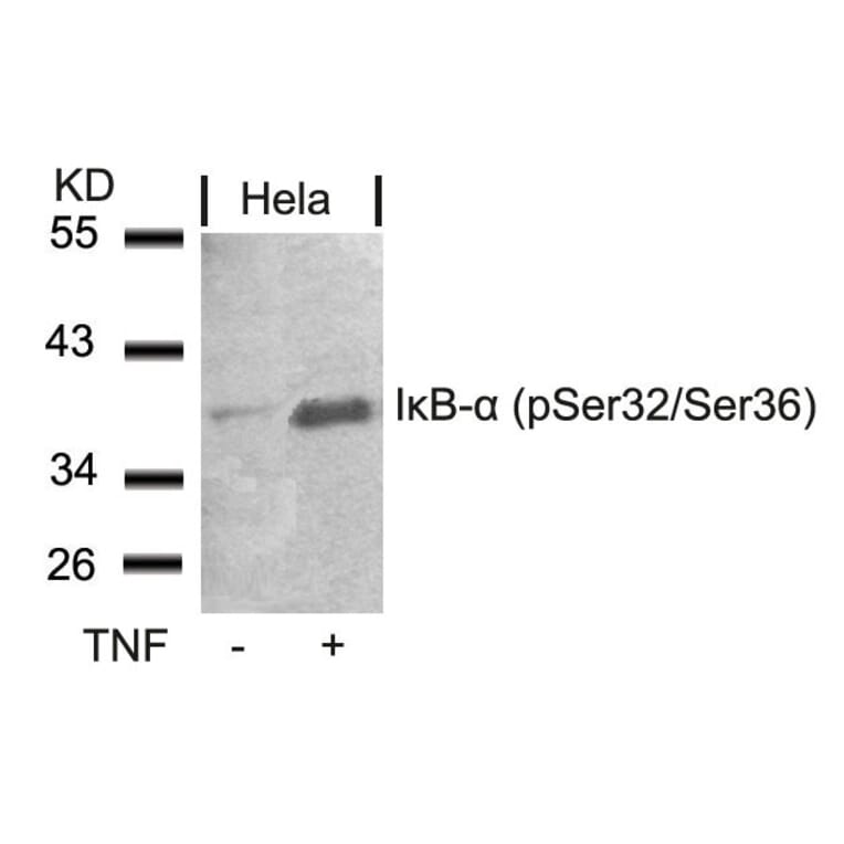 Western blot - IkB-a (Phospho-Ser32/Ser36) Antibody from Signalway Antibody (11152) - Antibodies.com