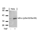 Western blot - IkB-a (Phospho-Ser32/Ser36) Antibody from Signalway Antibody (11152) - Antibodies.com