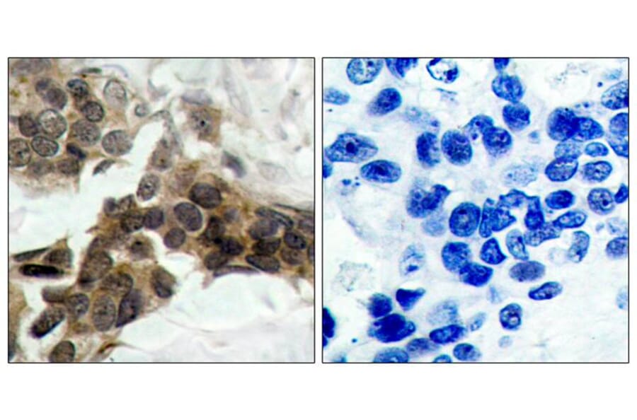 Immunohistochemistry - IkB-a (Phospho-Ser32/Ser36) Antibody from Signalway Antibody (11152) - Antibodies.com