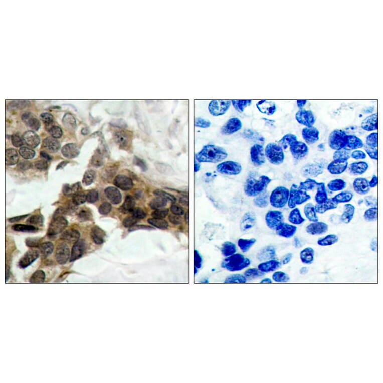 Immunohistochemistry - IkB-a (Phospho-Ser32/Ser36) Antibody from Signalway Antibody (11152) - Antibodies.com